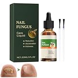 Nagelpflege Behandlung,Nagelpilz Behandlung Schnell Intensiv,Repariert...