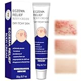 20g Ekzem Creme,Ekzemcreme,Ekzem Anti Juckreiz Creme,Repair...