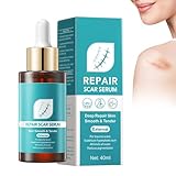 Serum zur Narbenreparatur, Reparaturessenz, natürliche Narbenessenz,...