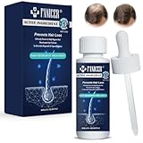 30ML Natürliches Haarwachstum für Männer & Frauen, Haarwuchsmittel zur...