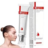 25g Akne Gel , Bekämpft wirksam Pickel und Mitesser bei Akne,Reduziert...