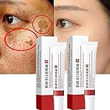 2PCS Whitening Freckle Cream,Scar Removal Treatment Cream,Haut Aufhellende...
