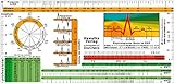 EKG Lineal -professional- II - inkl. Lagetypen, Lagekreis, Periodendauer